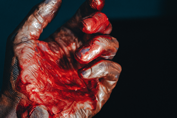 Do Sharks Like Human Blood Or Fish Blood?