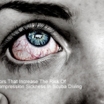 Factors That Increase The Risk Of Decompression Sickness In Scuba Diving small