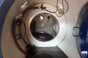 What Are The Signs And Symptoms Of Decompression Sickness?